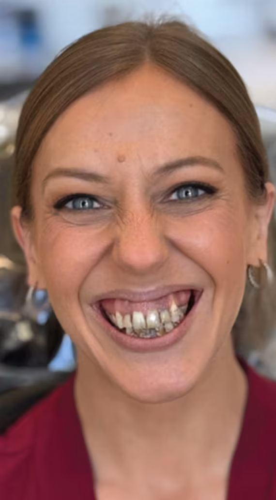 Smile before dental treatment
